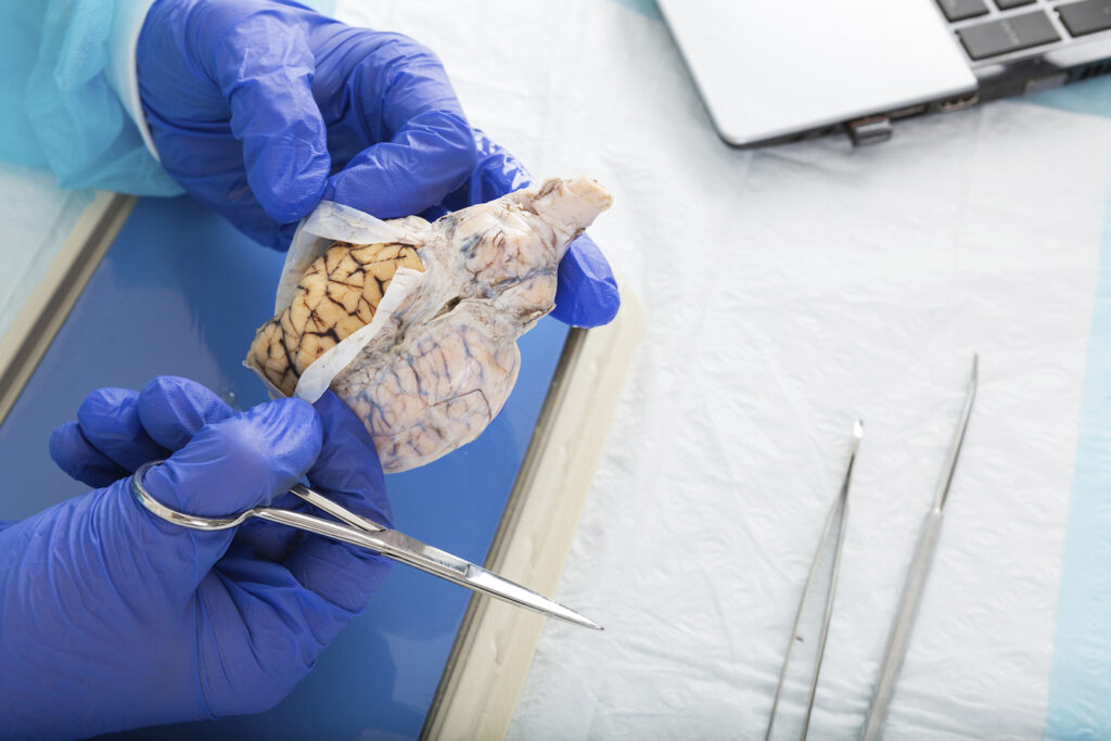 Cerveau de boeuf-tofu aussi alerte qu'une plante verte.